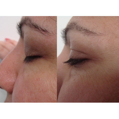 Lashes Serum 4ml