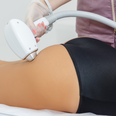 Buttocks Laser Hair Removal Treatment