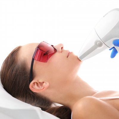 Chin Laser Hair Removal Treatment