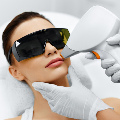 Upper Lip Laser Hair Removal Treatment