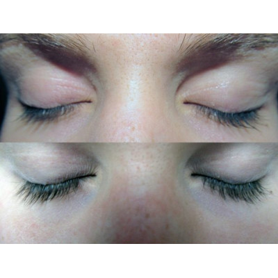 Lashes Serum 4ml Lashes Serum 4ml